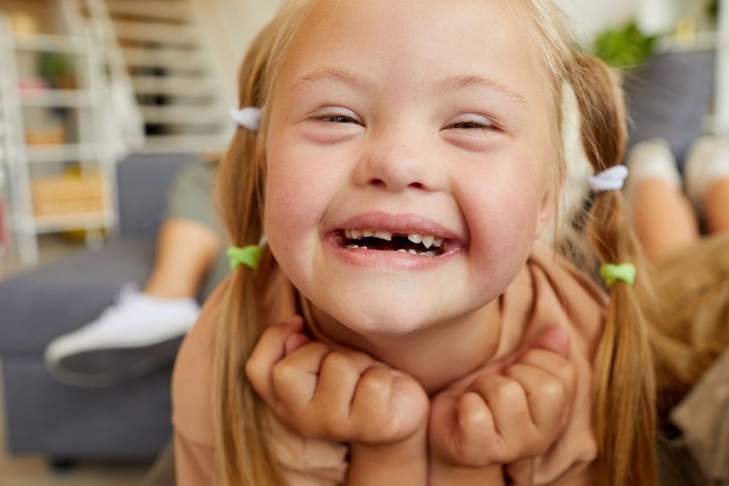 Close up portrait of blonde girl with down syndrome smiling happily looking at camera while lying on sofa at home